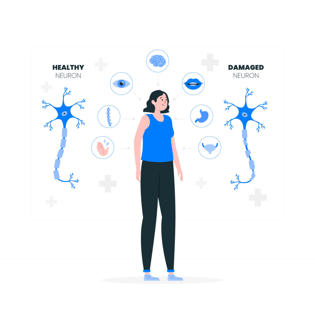 Multiple sclerosis is caused by an autoimmune condition in which the immune system attacks the myelin surrounding the nerves. This causes damage to the nerves.